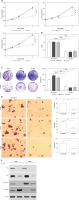 https://www.archivesofmedicalscience.com/f/fulltexts/122436/AMS-22-1-122436-g003_min.jpg