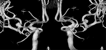 https://www.archivesofmedicalscience.com/f/fulltexts/122492/AMS-22-1-122492-g001_min.jpg