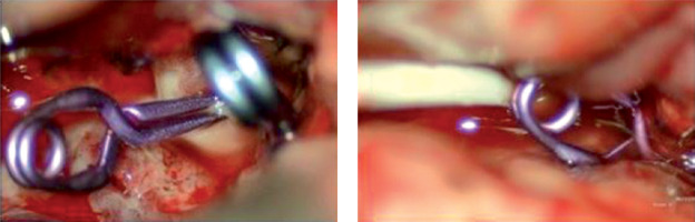 https://www.archivesofmedicalscience.com/f/fulltexts/122492/AMS-22-1-122492-g002_min.jpg