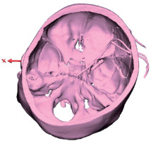 https://www.archivesofmedicalscience.com/f/fulltexts/122492/AMS-22-1-122492-g004_min.jpg