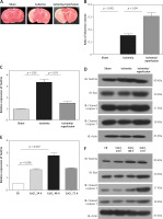 https://www.archivesofmedicalscience.com/f/fulltexts/122719/AMS-22-1-122719-g001_min.jpg