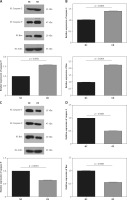https://www.archivesofmedicalscience.com/f/fulltexts/122719/AMS-22-1-122719-g004_min.jpg