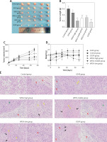 https://www.archivesofmedicalscience.com/f/fulltexts/122786/AMS-22-2-122786-g001_min.jpg