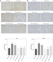 https://www.archivesofmedicalscience.com/f/fulltexts/122786/AMS-22-2-122786-g002_min.jpg