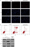 https://www.archivesofmedicalscience.com/f/fulltexts/123525/AMS-22-2-123525-g003_min.jpg