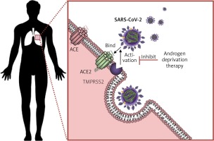 https://www.archivesofmedicalscience.com/f/fulltexts/123876/AMS-17-2-123876-g003_min.jpg