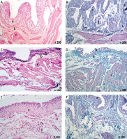https://www.archivesofmedicalscience.com/f/fulltexts/123936/AMS-22-1-123936-g001_min.jpg