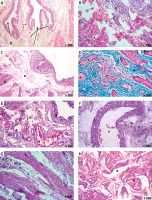 https://www.archivesofmedicalscience.com/f/fulltexts/123936/AMS-22-1-123936-g002_min.jpg