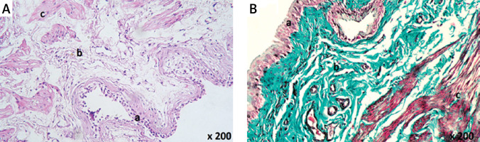 https://www.archivesofmedicalscience.com/f/fulltexts/123936/AMS-22-1-123936-g004_min.jpg
