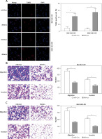 https://www.archivesofmedicalscience.com/f/fulltexts/124019/AMS-22-3-124019-g003_min.jpg