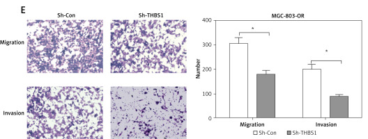 https://www.archivesofmedicalscience.com/f/fulltexts/124019/AMS-22-3-124019-g004_min.jpg
