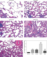 https://www.archivesofmedicalscience.com/f/fulltexts/124229/AMS-22-3-124229-g003_min.jpg