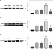 https://www.archivesofmedicalscience.com/f/fulltexts/124229/AMS-22-3-124229-g005_min.jpg