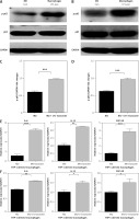 https://www.archivesofmedicalscience.com/f/fulltexts/124646/AMS-22-2-124646-g005_min.jpg