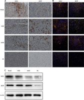 https://www.archivesofmedicalscience.com/f/fulltexts/124647/AMS-22-3-124647-g003_min.jpg