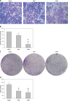 https://www.archivesofmedicalscience.com/f/fulltexts/124647/AMS-22-3-124647-g004_min.jpg