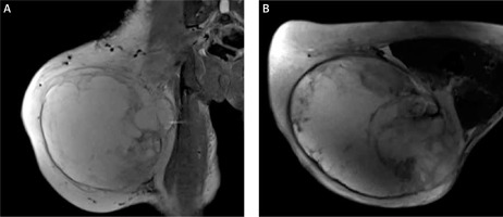 https://www.archivesofmedicalscience.com/f/fulltexts/124974/AMS-16-6-42217-g003_min.jpg