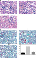 https://www.archivesofmedicalscience.com/f/fulltexts/124989/AMS-22-2-124989-g001_min.jpg