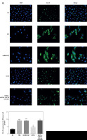 https://www.archivesofmedicalscience.com/f/fulltexts/124989/AMS-22-2-124989-g008_min.jpg