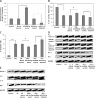 https://www.archivesofmedicalscience.com/f/fulltexts/125000/AMS-22-2-125000-g002_min.jpg