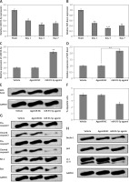 https://www.archivesofmedicalscience.com/f/fulltexts/125000/AMS-22-2-125000-g007_min.jpg