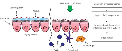 https://www.archivesofmedicalscience.com/f/fulltexts/125001/AMS-18-5-125001-g002_min.jpg