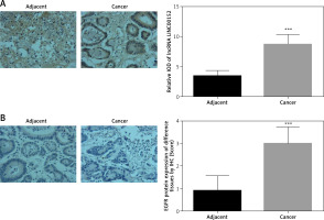 https://www.archivesofmedicalscience.com/f/fulltexts/125423/AMS-22-2-125423-g001_min.jpg