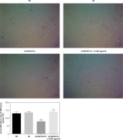 https://www.archivesofmedicalscience.com/f/fulltexts/125423/AMS-22-2-125423-g002_min.jpg
