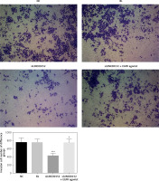https://www.archivesofmedicalscience.com/f/fulltexts/125423/AMS-22-2-125423-g005_min.jpg