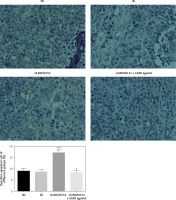 https://www.archivesofmedicalscience.com/f/fulltexts/125423/AMS-22-2-125423-g009_min.jpg
