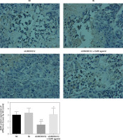 https://www.archivesofmedicalscience.com/f/fulltexts/125423/AMS-22-2-125423-g010_min.jpg