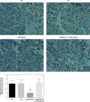 https://www.archivesofmedicalscience.com/f/fulltexts/125423/AMS-22-2-125423-g011_min.jpg