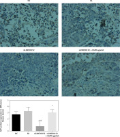 https://www.archivesofmedicalscience.com/f/fulltexts/125423/AMS-22-2-125423-g012_min.jpg