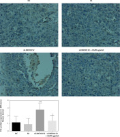 https://www.archivesofmedicalscience.com/f/fulltexts/125423/AMS-22-2-125423-g013_min.jpg
