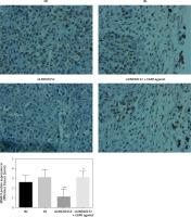 https://www.archivesofmedicalscience.com/f/fulltexts/125423/AMS-22-2-125423-g015_min.jpg