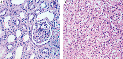 https://www.archivesofmedicalscience.com/f/fulltexts/125424/AMS-22-2-125424-g001_min.jpg