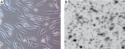 https://www.archivesofmedicalscience.com/f/fulltexts/125788/AMS-22-3-125788-g001_min.jpg
