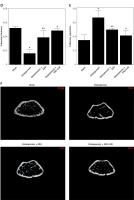 https://www.archivesofmedicalscience.com/f/fulltexts/125788/AMS-22-3-125788-g002_min.jpg