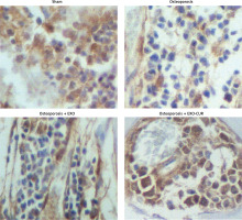 https://www.archivesofmedicalscience.com/f/fulltexts/125788/AMS-22-3-125788-g004_min.jpg