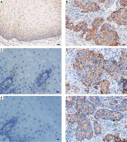 https://www.archivesofmedicalscience.com/f/fulltexts/125932/AMS-22-3-125932-g001_min.jpg