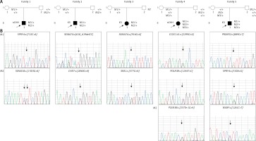 https://www.archivesofmedicalscience.com/f/fulltexts/126318/AMS-18-2-126318-g001_min.jpg