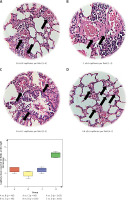 https://www.archivesofmedicalscience.com/f/fulltexts/126417/AMS-22-3-126417-g002_min.jpg
