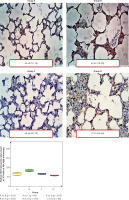 https://www.archivesofmedicalscience.com/f/fulltexts/126417/AMS-22-3-126417-g005_min.jpg