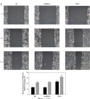https://www.archivesofmedicalscience.com/f/fulltexts/126839/AMS-22-3-126839-g003_min.jpg