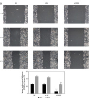 https://www.archivesofmedicalscience.com/f/fulltexts/126839/AMS-22-3-126839-g006_min.jpg