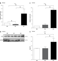 https://www.archivesofmedicalscience.com/f/fulltexts/127176/AMS-22-4-127176-g004_min.jpg