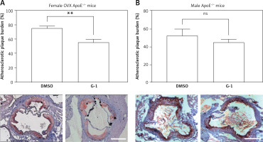 https://www.archivesofmedicalscience.com/f/fulltexts/127200/AMS-22-4-127200-g004_min.jpg