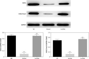 https://www.archivesofmedicalscience.com/f/fulltexts/127270/AMS-22-4-127270-g004_min.jpg