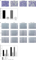 https://www.archivesofmedicalscience.com/f/fulltexts/127270/AMS-22-4-127270-g006_min.jpg