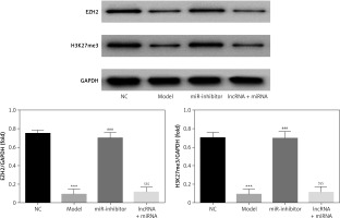 https://www.archivesofmedicalscience.com/f/fulltexts/127270/AMS-22-4-127270-g007_min.jpg